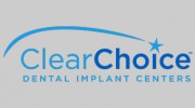 Clear Choice Dental Implant